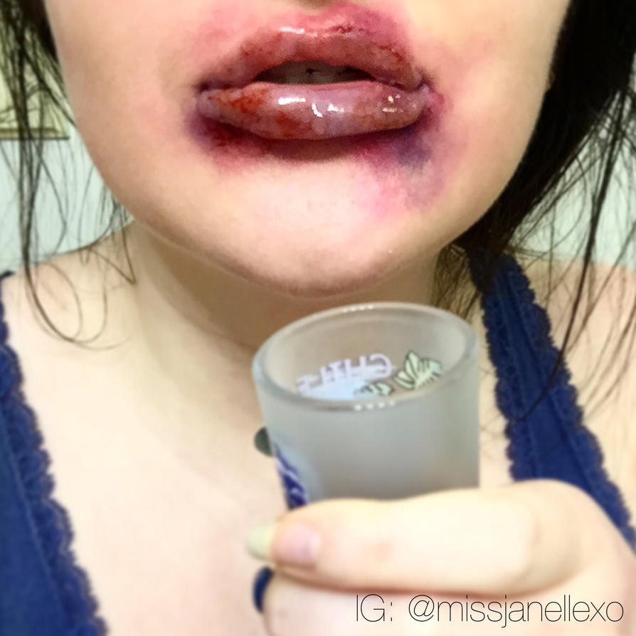 Image result for kylie jenner lip challenge