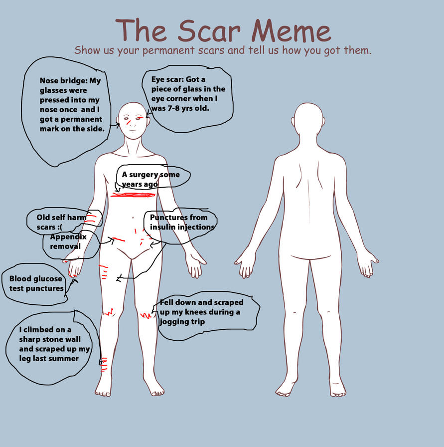 The Scar Meme XD By CoffeeToffeeSquirrel On DeviantArt